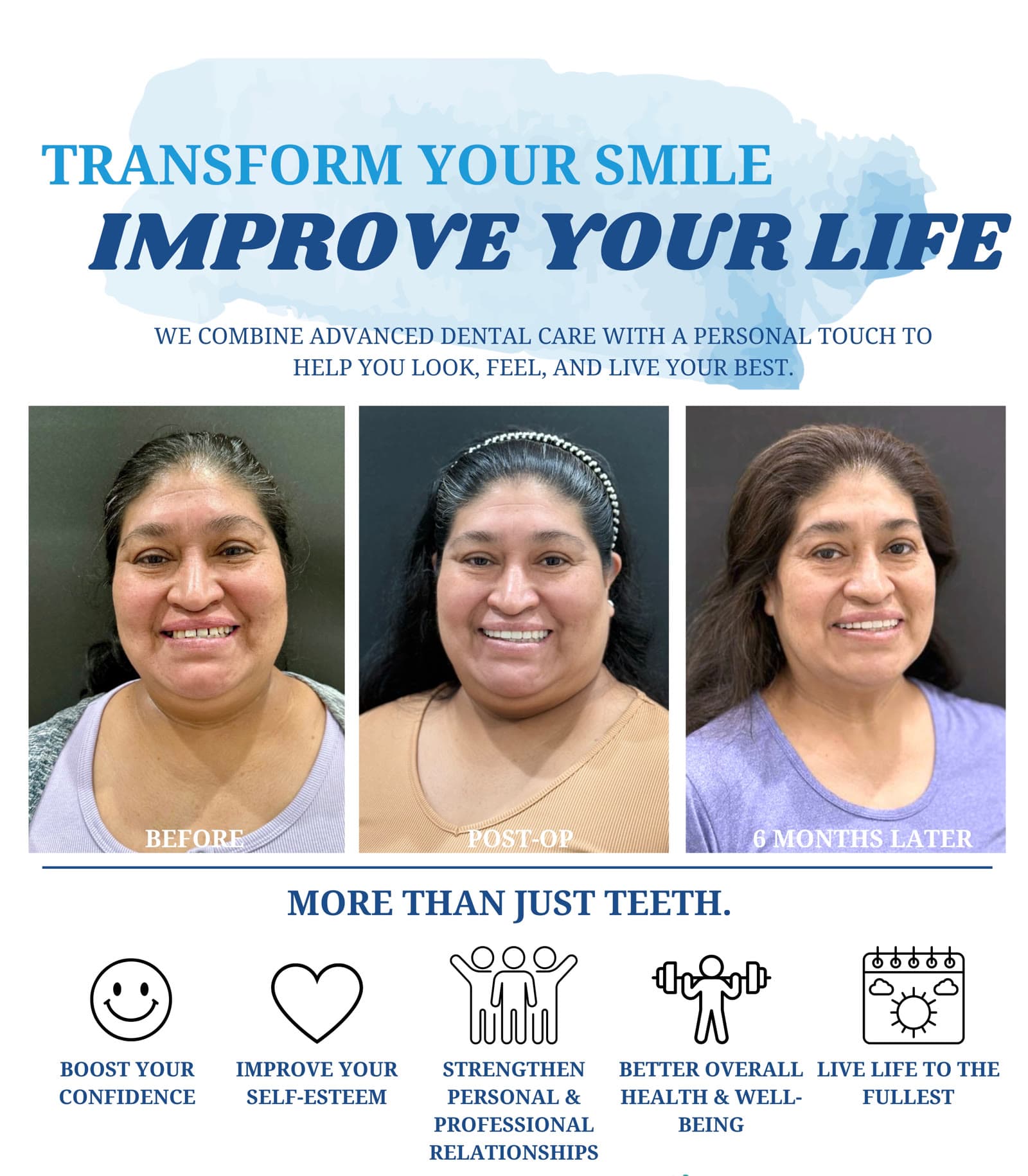 Roxanna, a Southern Smiles patient before and after treatment