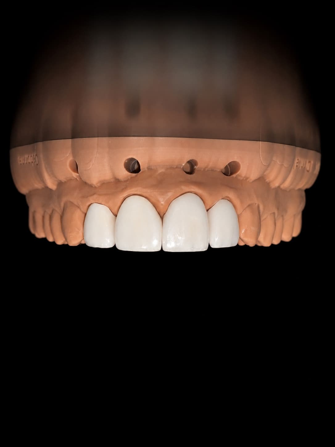 Front view of Hazel's four hand-layered veneers on the working model