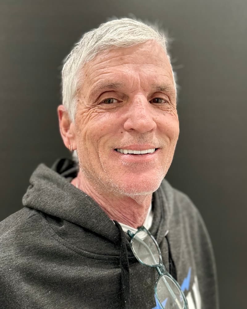 John after full-arch implant treatment at Southern Smiles