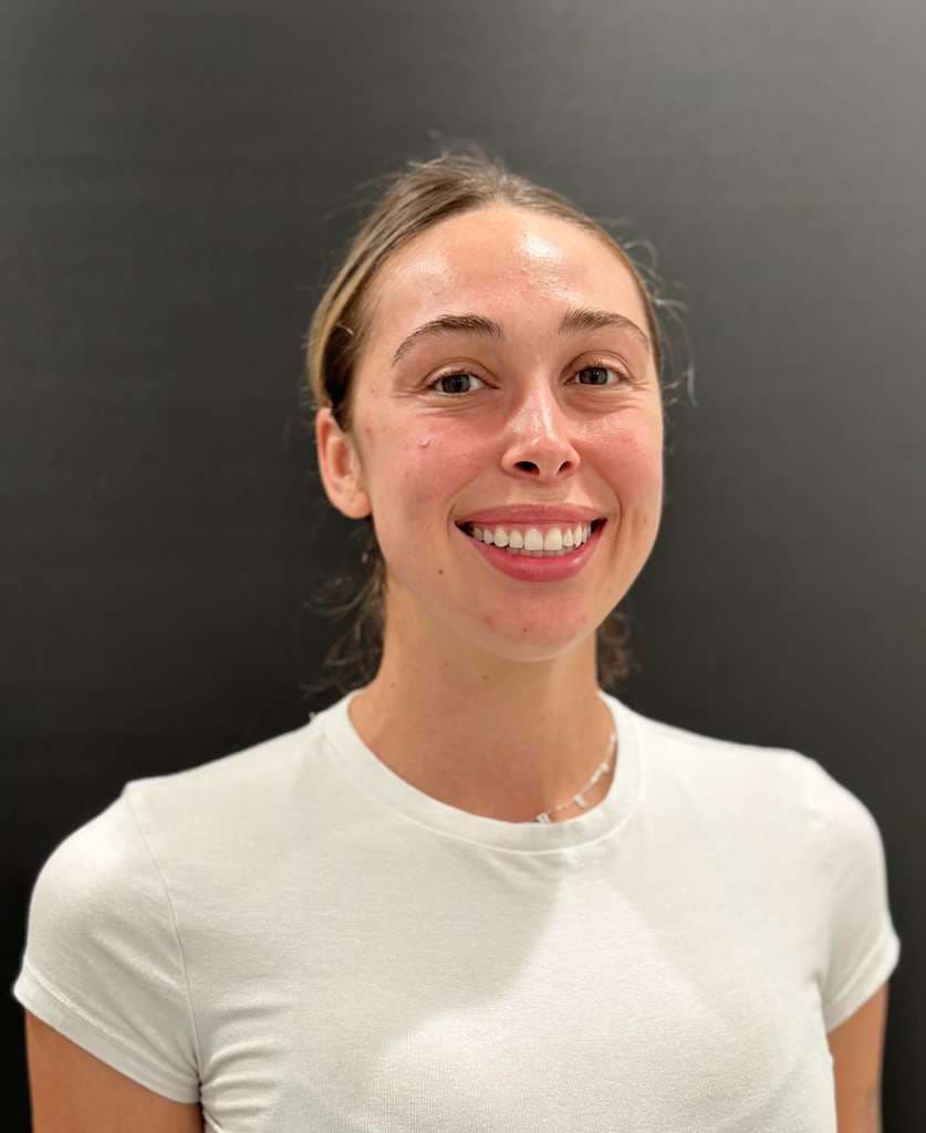 Drea después de Invisalign en Southern Smiles
