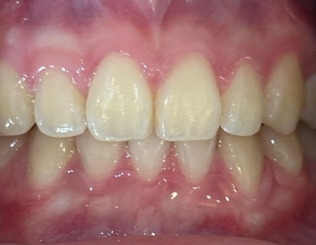 Case 2 after