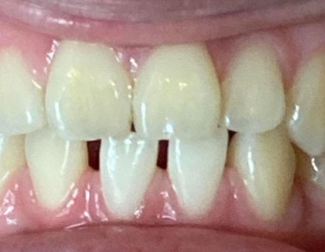 Case 2 before