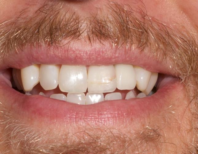 Case 4 before