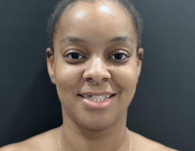 Chelsea Full Face Before