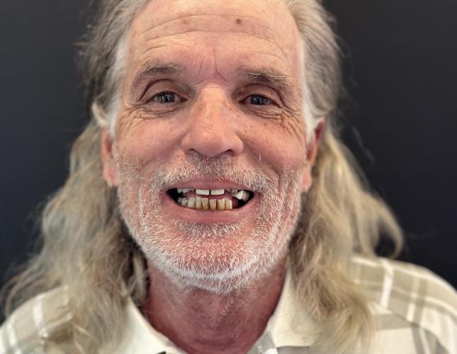 John Full Face Before