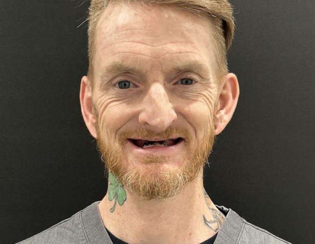 Travis Full Face Before